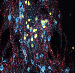 Сергей Лопатин Биология стресса Лекция 3 Хронический стресс 2024
