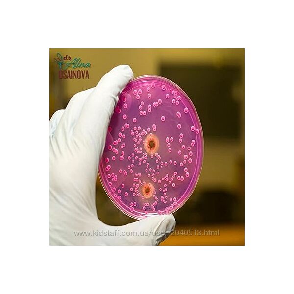 Алина Усаинова - Хочу избавиться от кандидоза