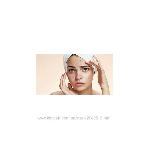 Амина Пирманова - Акне у девушек и женщин руководство от дерматолога