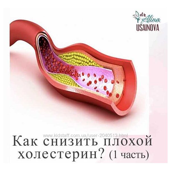 Алина Усаинова - Как снизить плохой холестерин